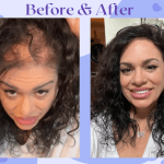 InvisaBlend Before and After pictures