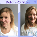 InvisaBlend Before and After photos